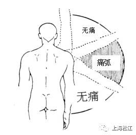 怎么会得肩周炎？如何预防和治疗？看这里→