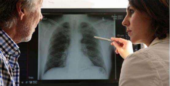 肺癌高发危害极大，到了晚期都有哪些症状？医生：需注意以下几点