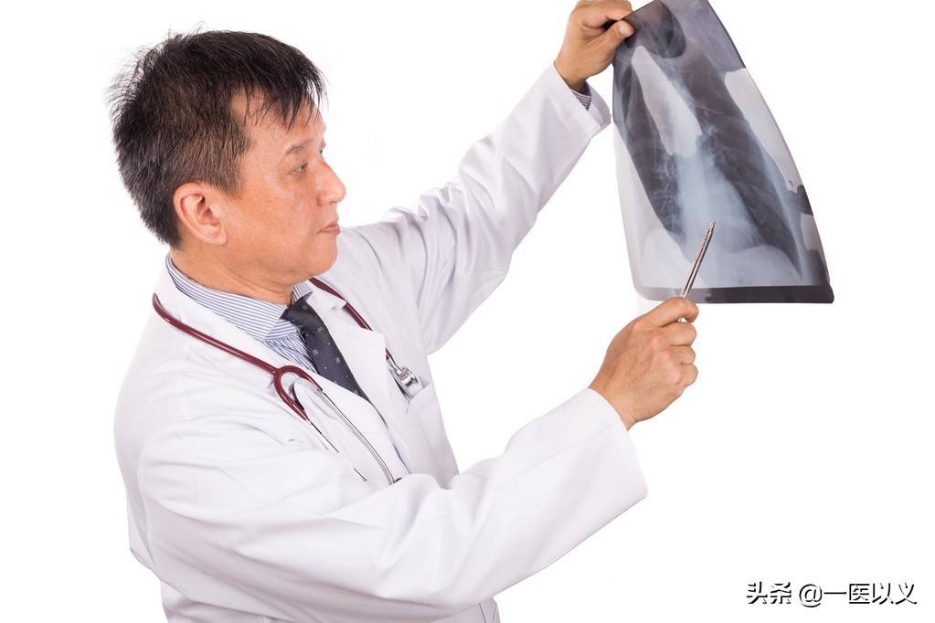 肺CT多久做一次，不同人群的肺部检查推荐