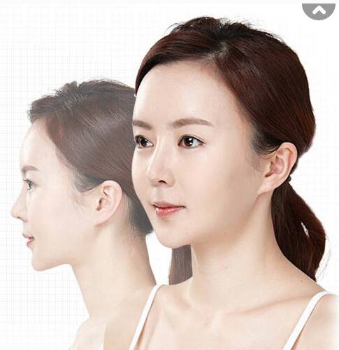 韩国整形专家教你隆鼻护理小窍门