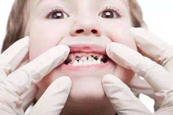 宝宝啥时开始长牙？为啥长蛀牙？用啥牙膏好？娃牙齿问题一次讲透