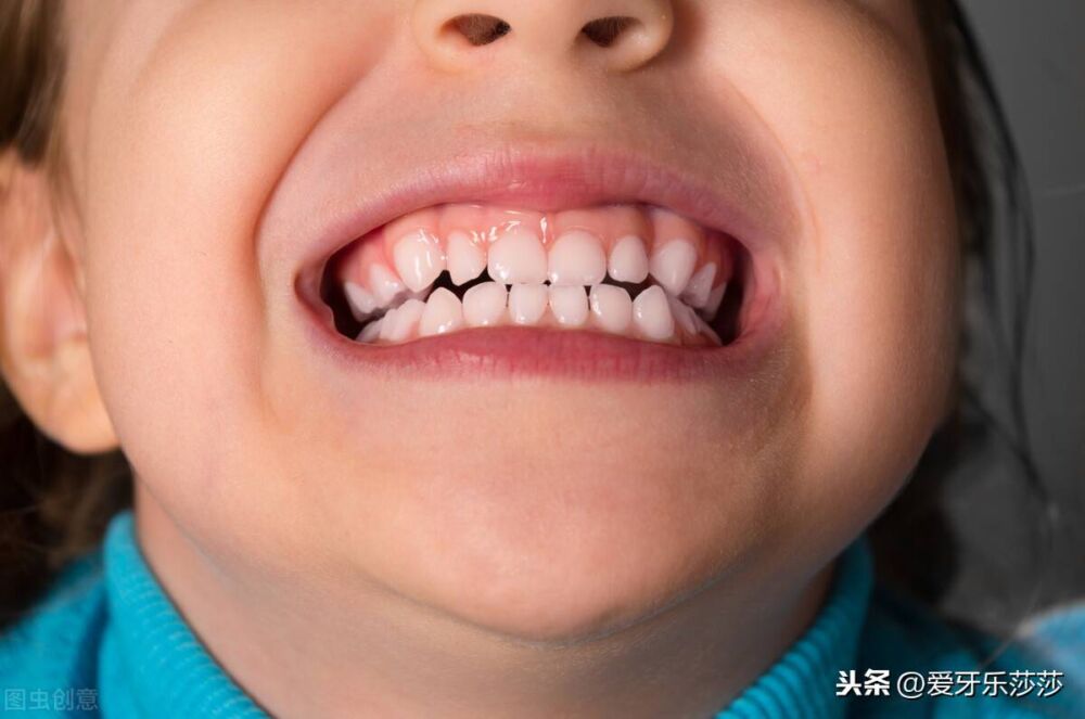 为什么孩子换牙后牙齿会长歪？做好这几点、牙齿整齐又好看