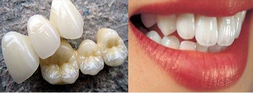 牙龈发黑，刷都刷不掉是什么引起的？该怎么补救？