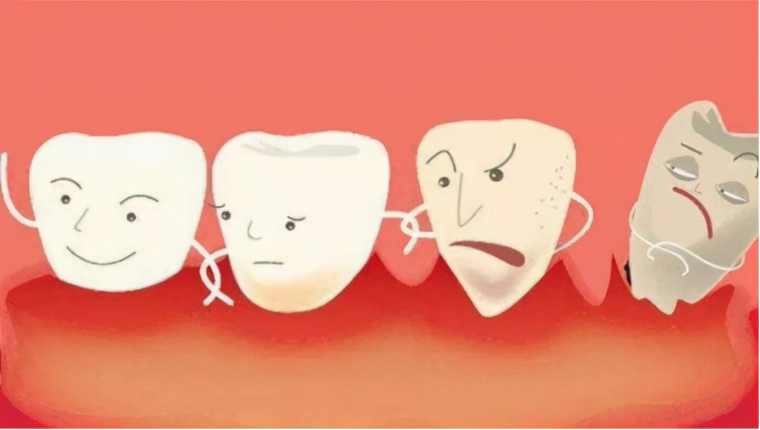 牙齿痛是什么原因？#雅悦齿科#
