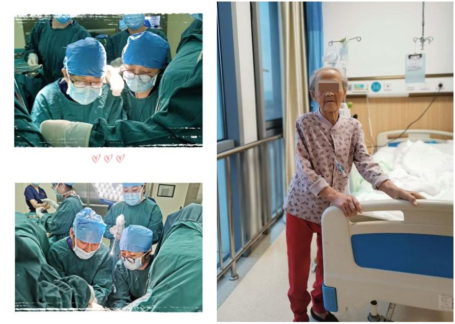 太原市中心医院妇科成功为超高龄重度子宫脱垂患者解除病痛