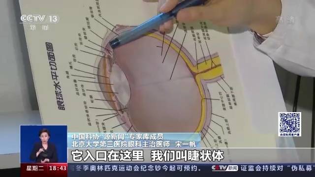 错用眼药水导致青光眼！眼药水种类繁多，如何科学使用？