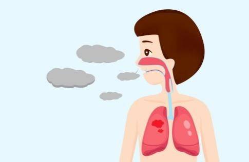 支气管炎该怎么治？