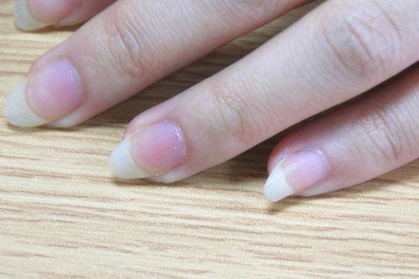 指甲上的“月牙”消失，是身体要生病吗？了解一下