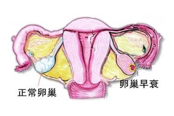 春玲医生健康说：早发性卵巢功能不全（POI）