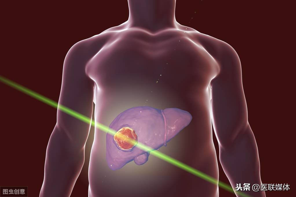 肝癌来了，身体有哪些预兆？这5种表现很常见