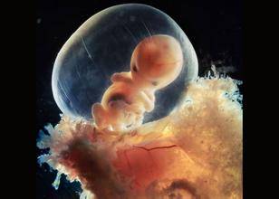 胎儿附属物胎盘、胎膜、脐带、羊水的形成与功能，你知道吗？