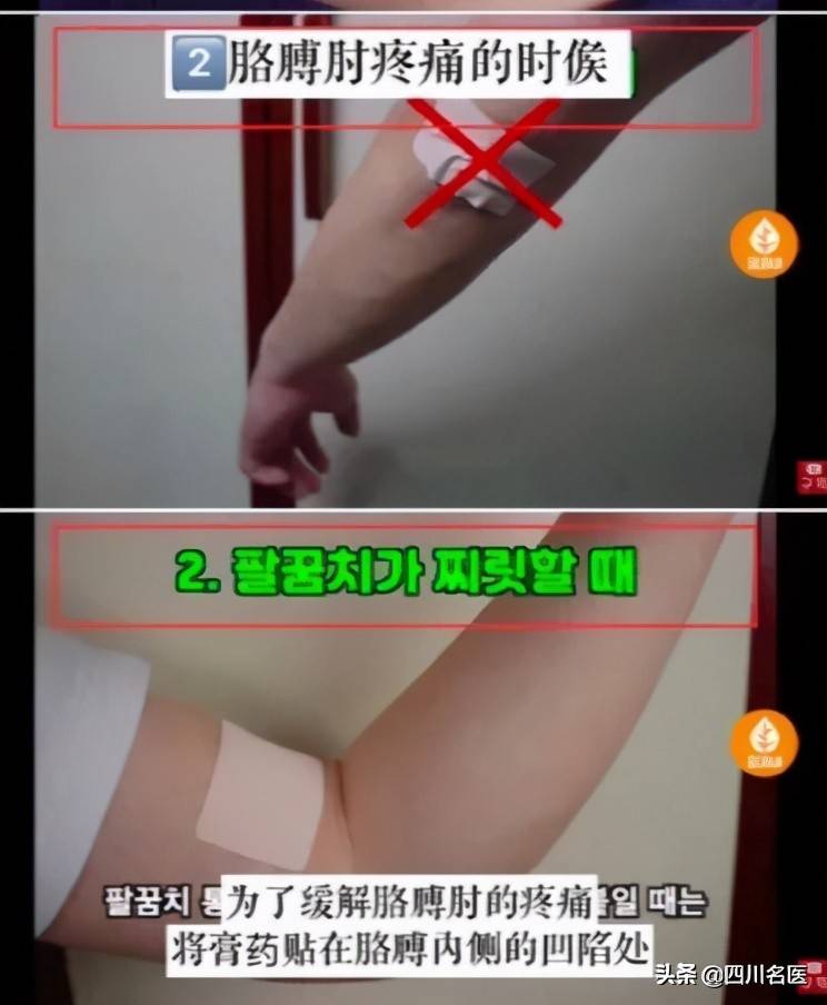 哪儿痛贴哪儿？医生：贴了这么多年的膏药，很多人都没搞对