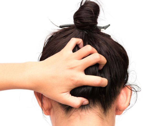 头皮疼痛，不仅是头的问题，也要注意这5个原因