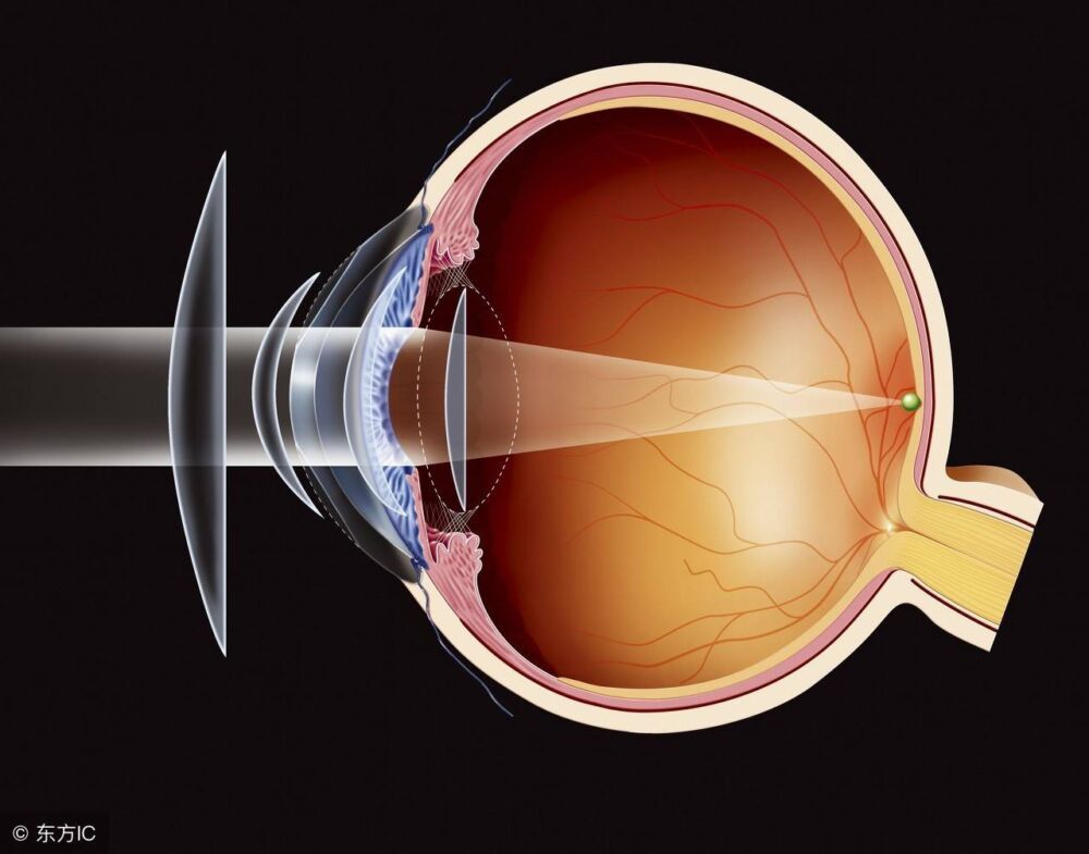 眼睛凸出是因为长期佩戴眼镜？这个锅，眼镜可不背
