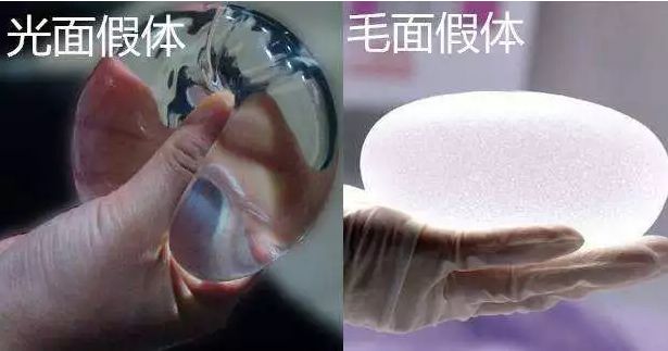 假体隆胸术后和术前乳房手感差别很大吗？