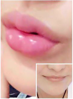 韩式漂唇有危险，需要注意哪些问题