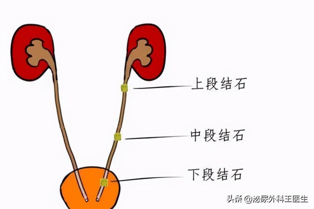 你了解过坦索罗辛吗？除了改善尿频，还能治疗3种常见的男科疾病