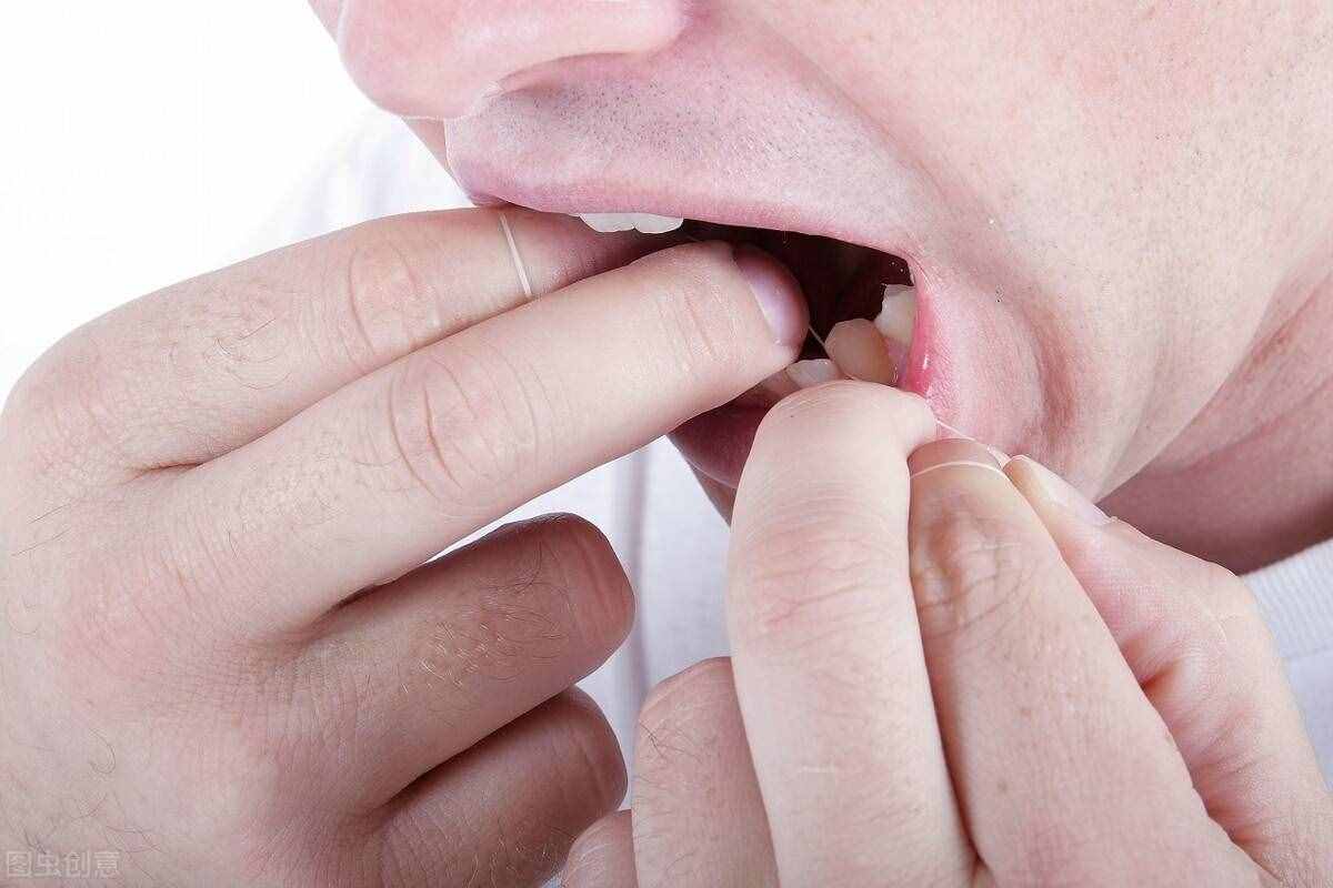 口腔扁平苔藓的治疗和护理需要注意什么？