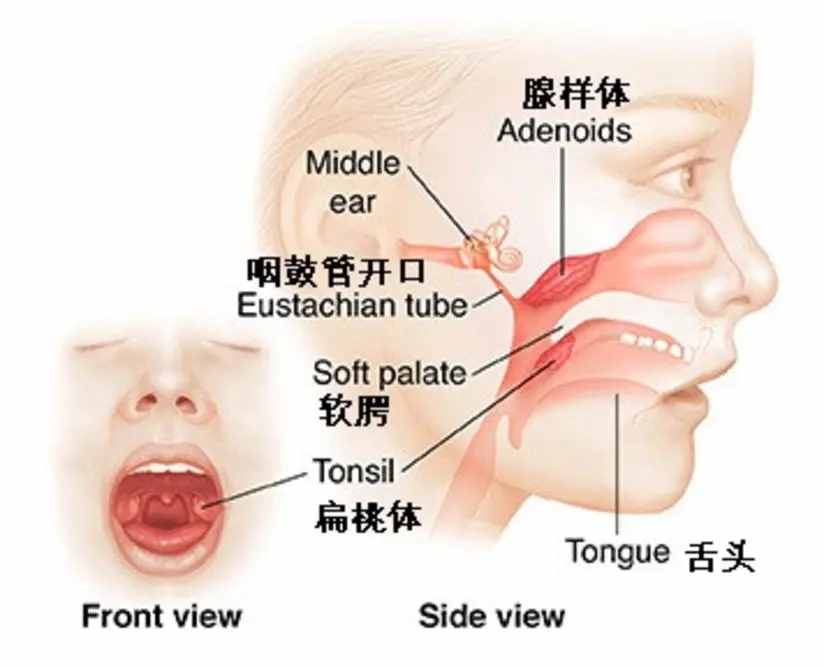 你知道吗？扁桃体腺样体术后需要注意这些事情