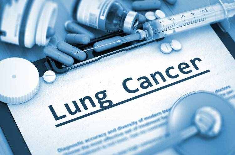 生存期超过6年，中国专家研发治疗新方案，晚期肺癌患者有救了