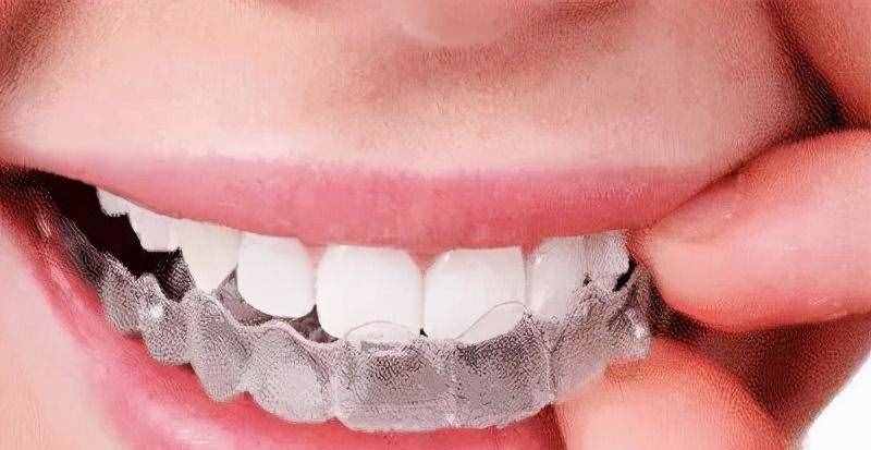 牙齿矫正结束后，保持器究竟要戴多久？