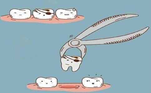 拔完牙不能吐口水？注意！拔牙后的护理比拔牙还重要 #雅悦齿科#