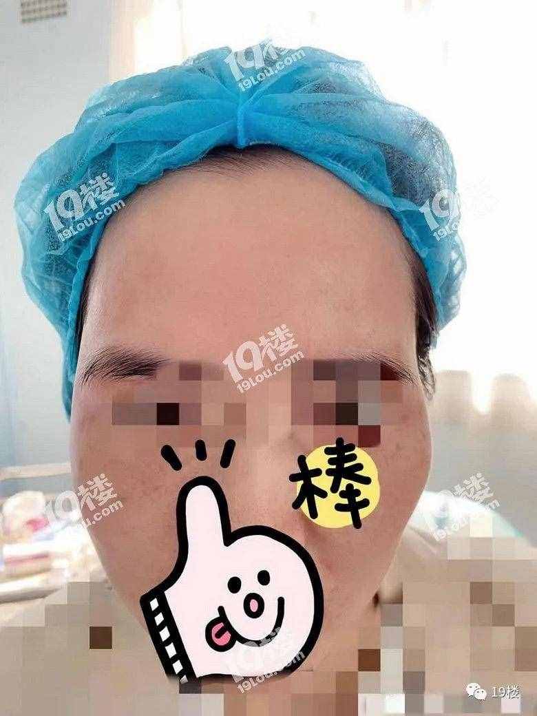 杭州姑娘花2万5做鼻子，结果呼吸困难生活都不能自理了……