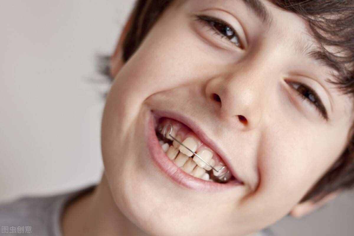 牙齿矫正价格为什么会有这么大的差别？