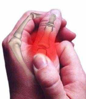 听说经常掰响指关节会得关节炎、手指会变粗？真相是……