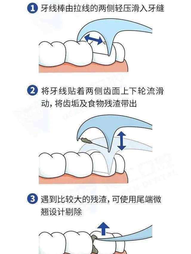 什么牙线你还不会用？给我去学