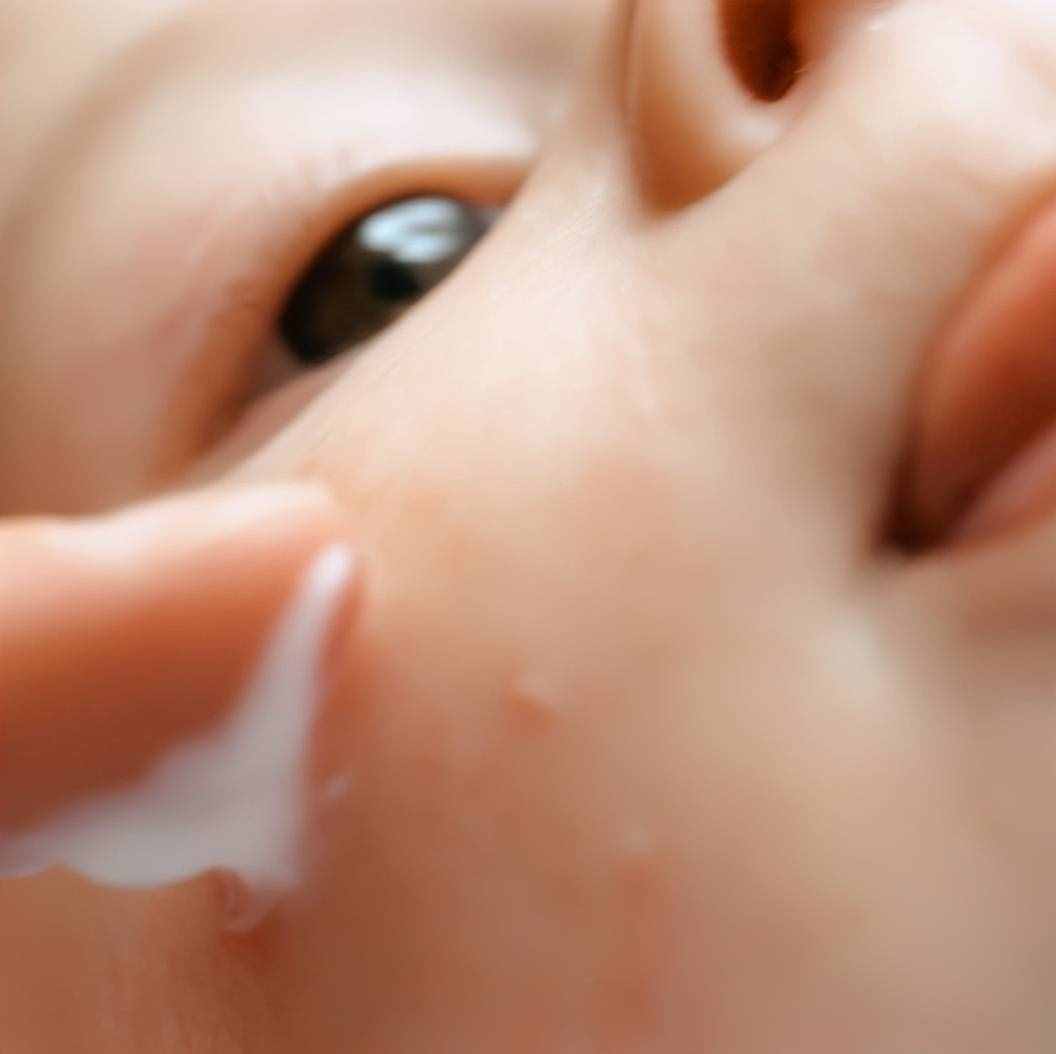 宝宝反复湿疹、干燥起皮，怎么办？