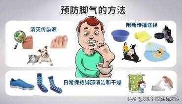 夏天总被“脚气”尴尬困扰？皮肤科医生告诉你，3种方法治脚气