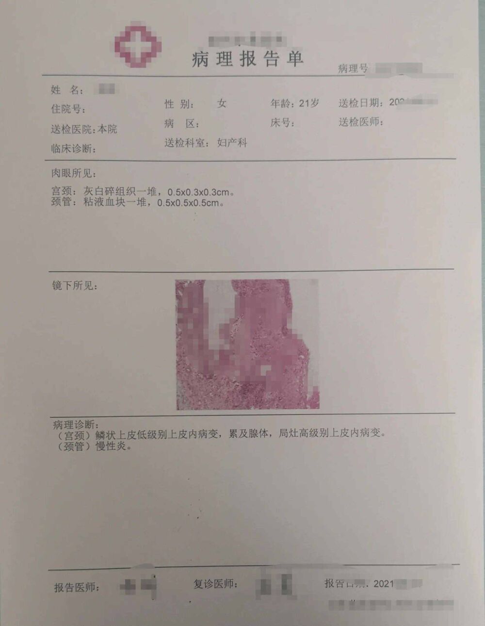 今天这三张病理报告提醒：HPV16和HPV18阳性，一定要引起重视