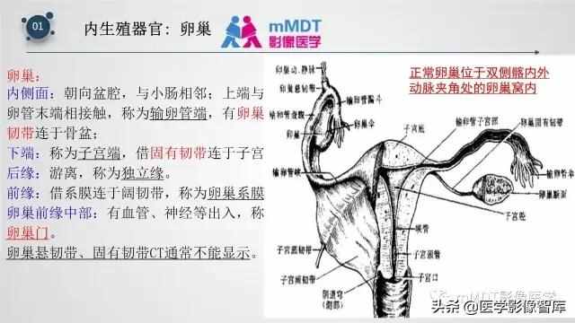 子宫附件影像解剖