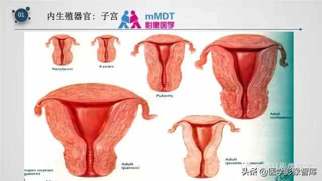 子宫附件影像解剖