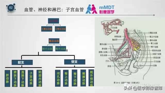 子宫附件影像解剖