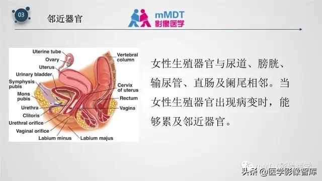 子宫附件影像解剖