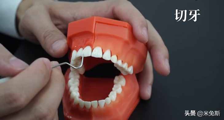 大家对每个牙齿真正的样子了解吗？