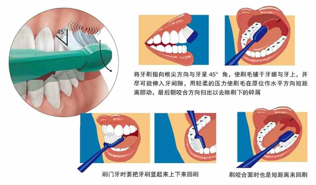 选对牙膏和牙刷很重要：牙齿美白看过来