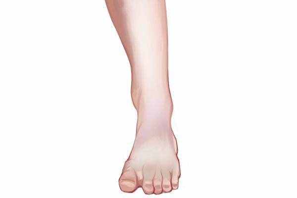 脚崴了症状有哪些？应该采取怎样的措施，帮助身体恢复？
