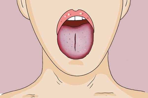舌苔白厚、肚子隐痛，是哪种湿气重？有什么调理的好方法？