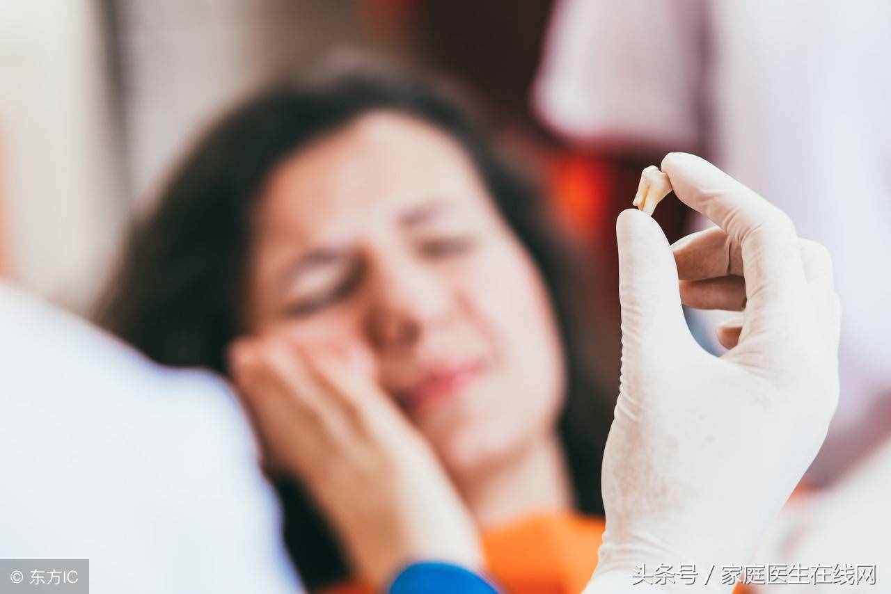 牙科医生：拔牙之后想要快点恢复，这6个事项要记清楚