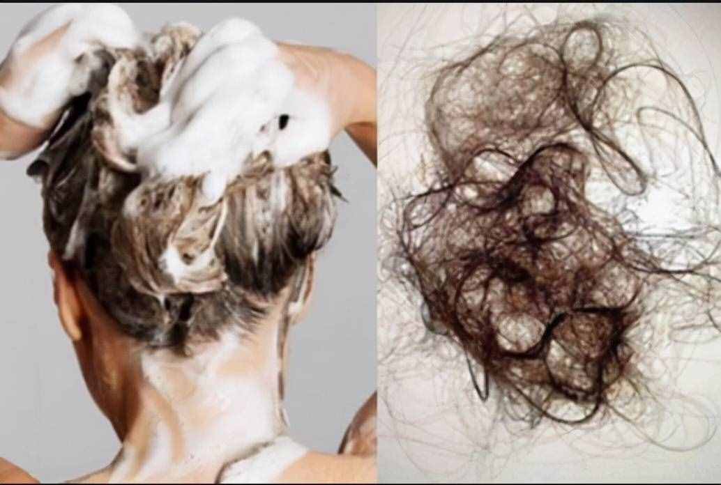 脱发、掉发、头皮出油？是你洗头方式不对！植发医生教你科学洗头
