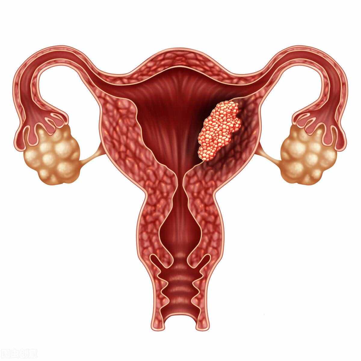 女性下腹痛，警惕9种生殖系统病，或可诱发严重后果，一定要看看
