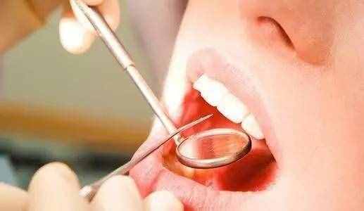 “牙结石”可以自己抠掉吗？教你一招，牙缝的脏东西或能轻松掉