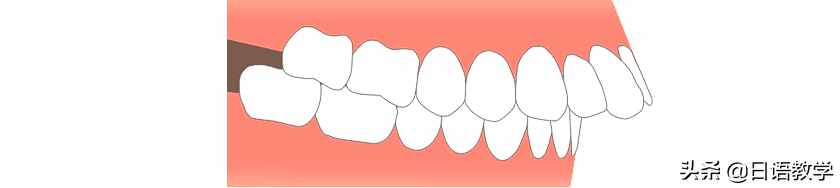 为什么日本人牙齿不齐？你知道多少？