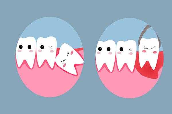 为什么很多人会长智齿？什么情况下需要拔掉智齿？文章告诉你