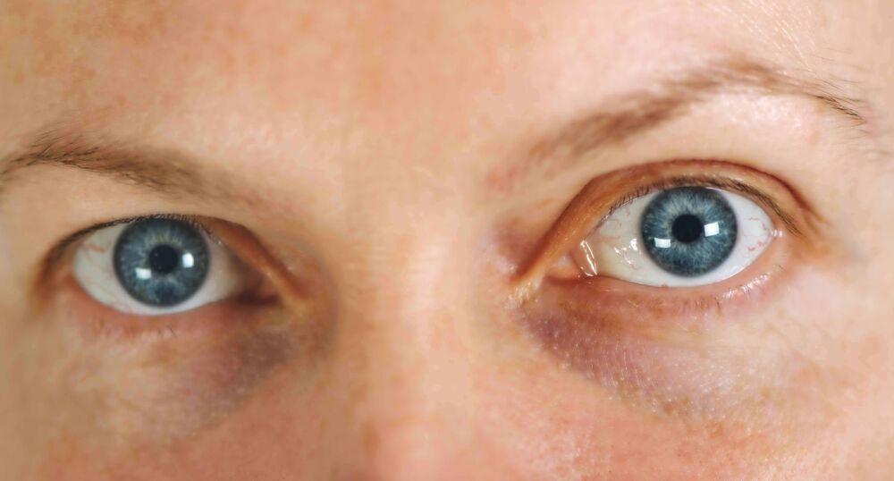 体内有癌，眼睛先知？提醒：眼睛出现这种颜色，尽早去排查肝癌