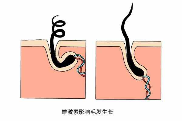 胡子长得快，是啥原因导致的？提醒：与2个因素有关，不妨对照下