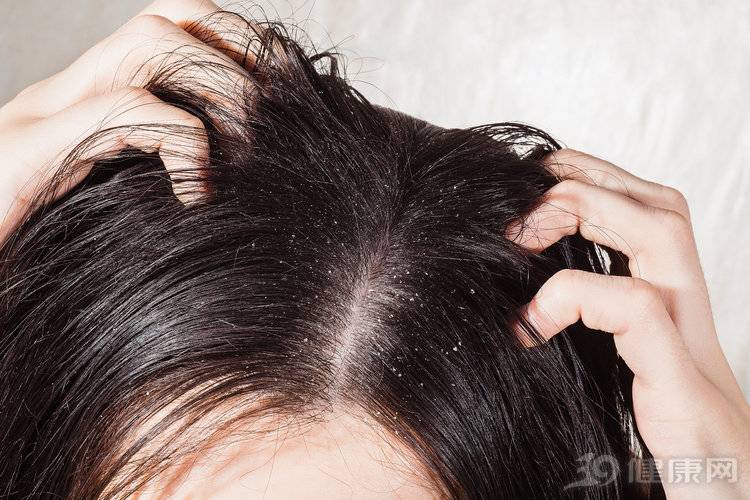 10款洗发水测评：2款检出甲醛，3款检出致癌物！你还敢用吗？